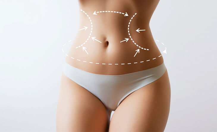 360 Liposuction