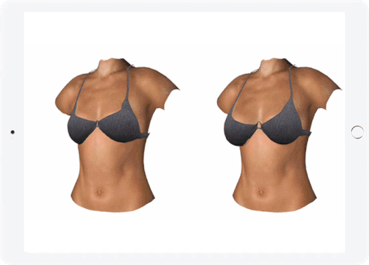 3d breast view