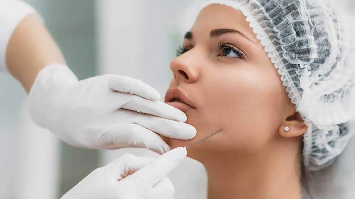 Benefits of Thread Lift 