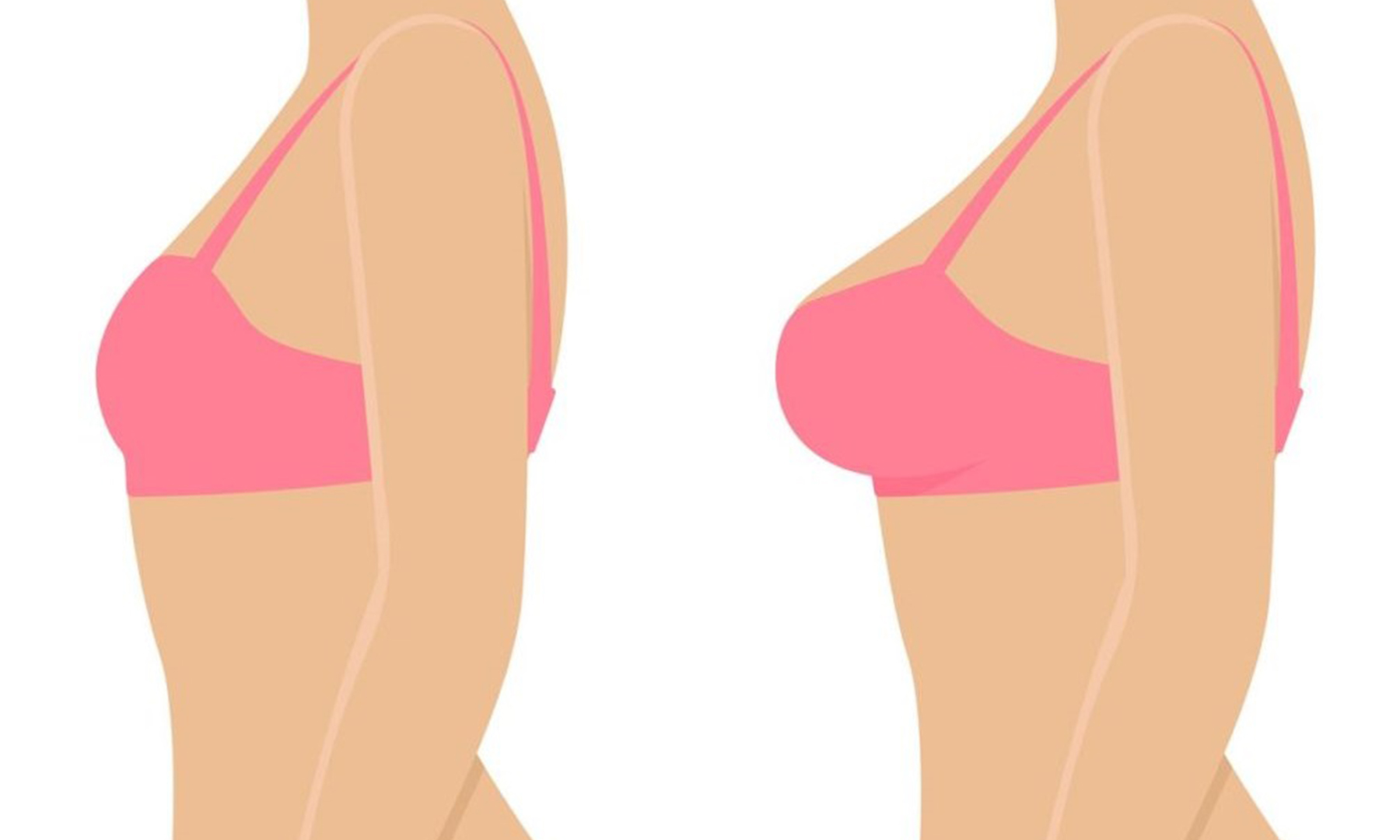 breast female