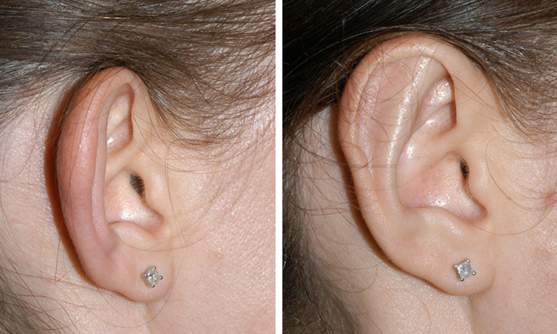 ear female