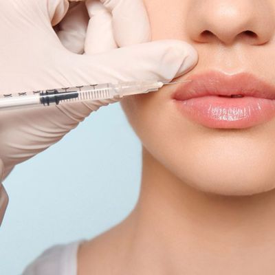 Fillers